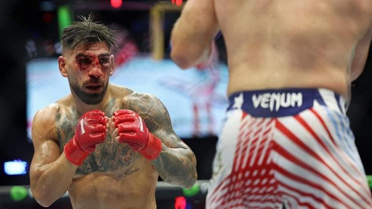 Topuria, drammatiche le conseguenze del ko nel match di MMA davanti a Trump: fratture alle orbite