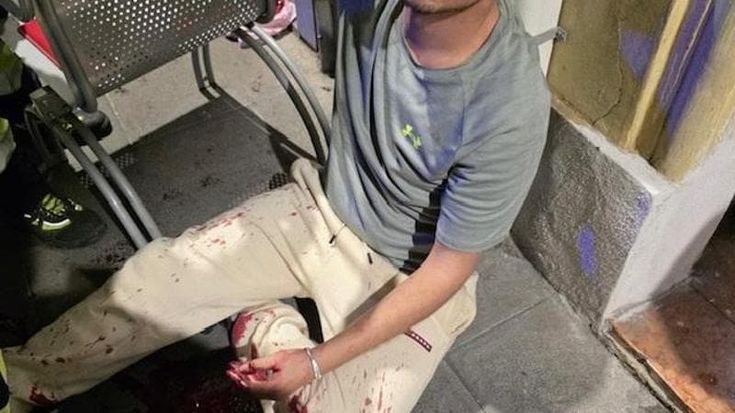 Termini, aggredito dal branco con un coccio di bottiglia rischia di morire dissanguato