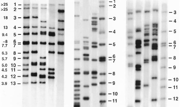 Garlasco, il genetista Novelli sul Dna: “Ecco perché l’esame è importante e che risposte fornisce”