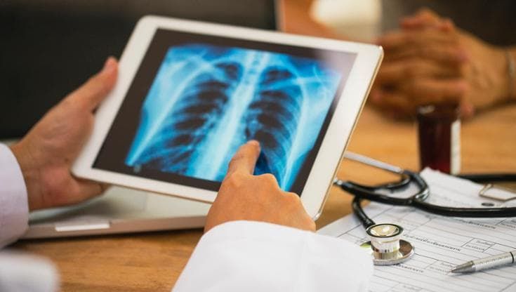 Tumore al polmone, una nuova opzione terapeutica per i carcinomi con mutazione Kras