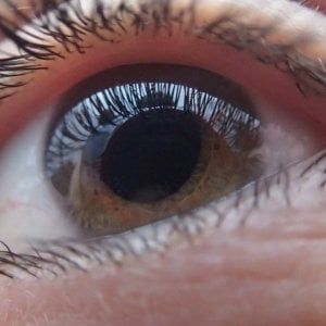 Occhi: arriva il primo farmaco biologico contro l'uveite