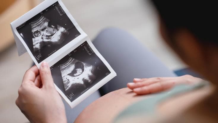 Tumori, alla ricerca di farmaci per proteggere la fertilità