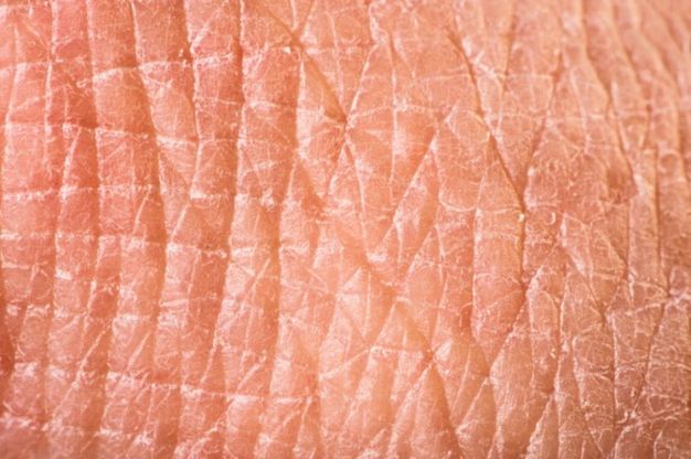 Pelle artificiale sempre pi&ugrave; simile a quella dell'uomo