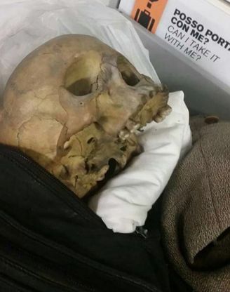 Roma, teschio nel bagaglio a mano: professore denunciato a Fiumicino