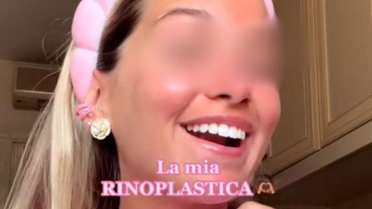 La chirurgia estetica viaggia sui social: carica di influencer che raccontano in diretta i ritocchini. Ma gli esperti avvertono: “Attenti ai rischi”