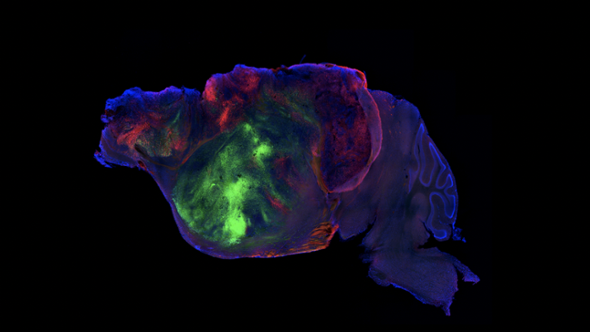 Cellule cerebrali umane trapiantate nei topi: i ricercatori hanno realizzato l’integrazione “più estesa” mai registrata
