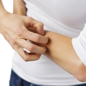 Dermatite atopica, se perdi l’equilibrio la pelle s’infiamma 