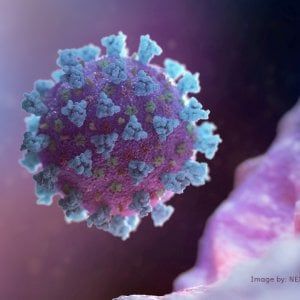 Palermo, cinque positivi al coronavirus ricoverati nella notte. Fra loro una donna incinta