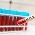 Epatite B, approvato negli Usa un farmaco che permette la “cura funzionale”