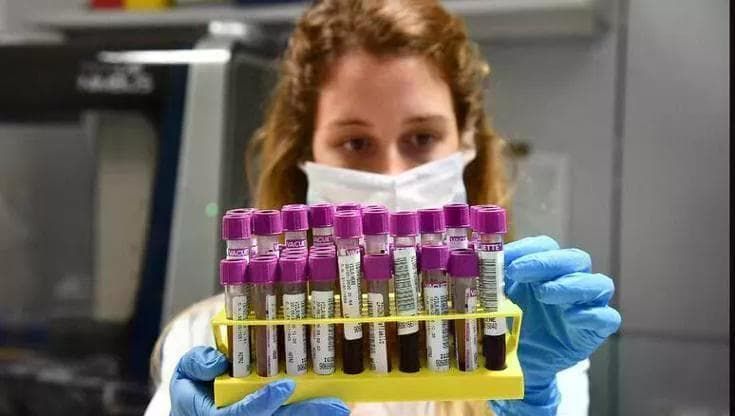 Alzheimer, la nuova mappa del rischio è nel sangue