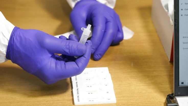 Coronavirus, 1.076 nuovi casi (130 a Parma). Prosegue il calo dei ricoveri 