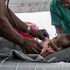 Epidemia di Morbillo in RDC: sforzi insufficienti per arginare la più grande pandemia in corso nel mondo  