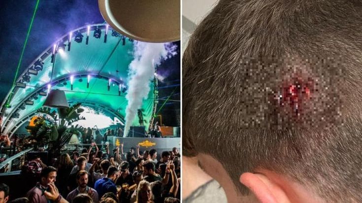 Mette una mano sulla spalla del buttafuori, ragazzo romano picchiato a Valencia: “Ho visto il sangue, poi il buio”