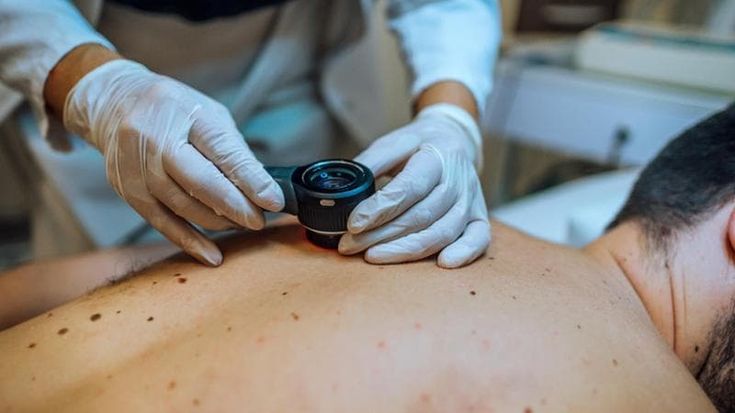 Tatuaggi, cosa cambia con la nuova legge. Dai nei ai melanomi, tutto quello che c’è da sapere