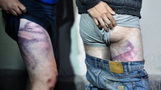 Bielorussia, le ong denunciano: "Torture contro i manifestanti". Tikhanovskaja : "Basta violenze, al governo chiedo dialogo"