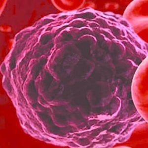 Un’arma in più nella lotta alla leucemia 