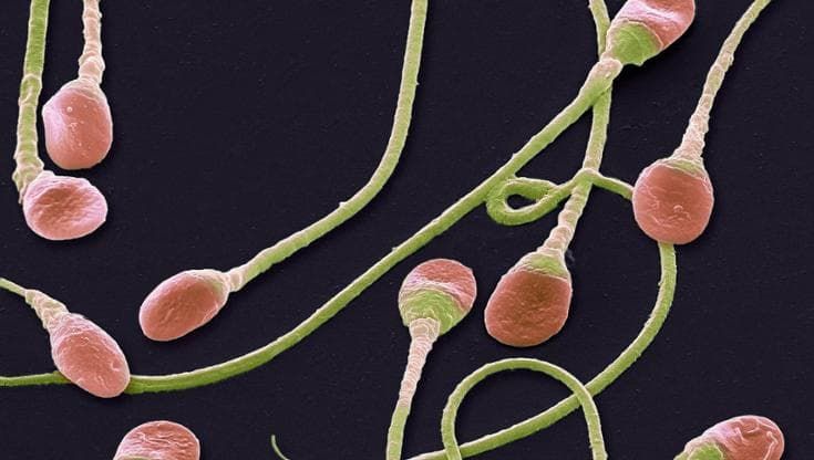 A 10 anni congela tessuto testicolare prima della chemio: 16 anni dopo uno spermatozoo. Prima volta