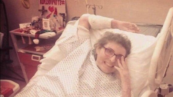 Ex marito le diede fuoco, dopo un anno Maria Antonietta Rositani torna 'a casa': "Segnale di speranza"