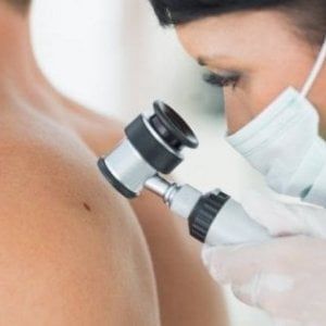 Melanoma: così cambia il trattamento dopo l’intervento chirurgico