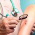 Melanoma, il primo vaccino personalizzato a mRNA riduce del 42% il rischio che il tumore ritorni