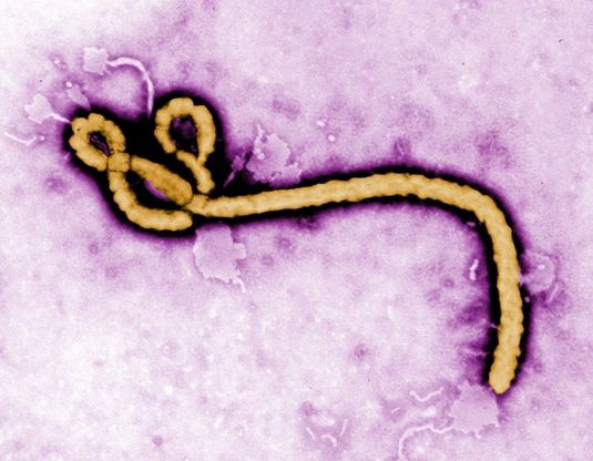L'Oms: si rischiano 20mila casi di Ebola in Africa occidentale