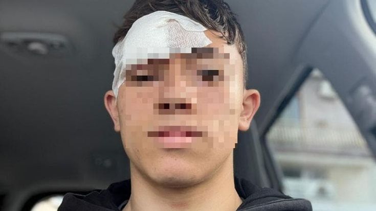 “Io, ferito allo stadio, rischiavo di perdere un occhio: inconcepibile farsi male per una partita”
