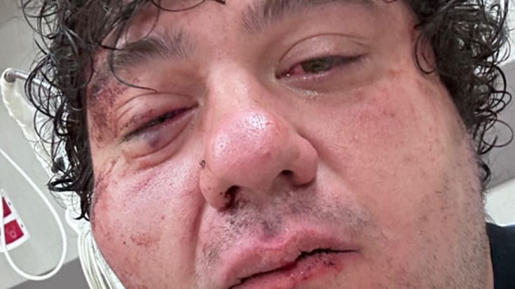 San Lorenzo, il rapper Ozymandias massacrato dal branco: “Mi hanno preso a calci in faccia”