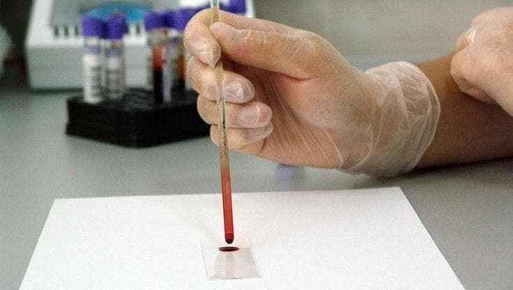 Un test del sangue promette di scoprire i tumori in anticipo