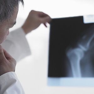 La ragazza che una malattia rara sta trasformando in una statua