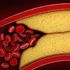Colesterolo-LDL, a chi servono i farmaci orali per ridurlo e quando utilizzarli