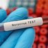 Norovirus, che cos’è e come si trasmette