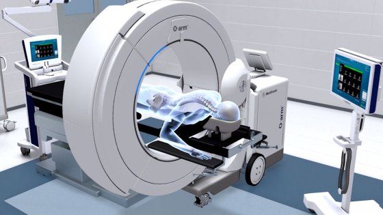 Neurochirurgia, all'Humanitas di Milano un super robot guida l'intervento: "Così riduciamo i rischi"