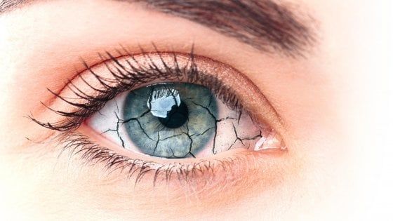 Occhio secco, casi in aumento anche  acausa dell'inquinamento