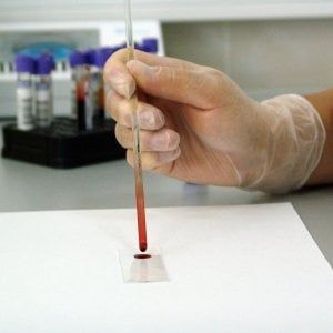 Allo studio un nuovo test per scoprire i tumori