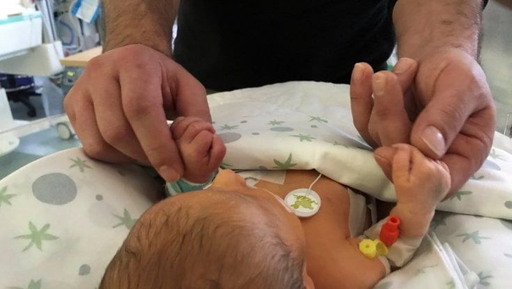 Operazione salvavita al Bambino Gesù, così Chloe, affetta da una rara malformazione, 'rinasce' la notte di Capodanno
