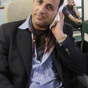 Aggredisce un controllore sul tram e gli stacca l'orecchio a morsi