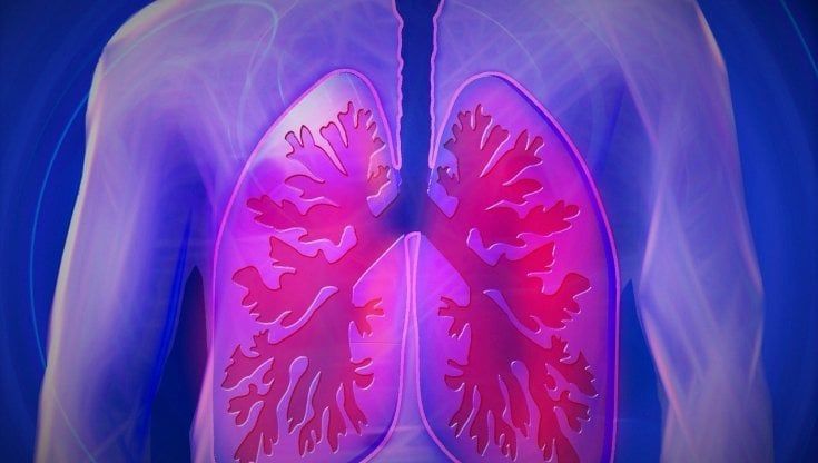 Doppia immunoterapia per il tumore del polmone