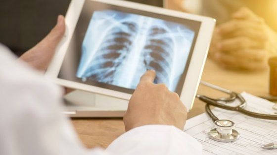 Polmonite interstiziale, perché è diversa