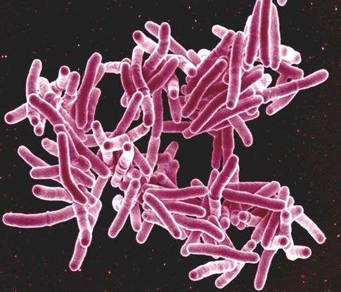 I batteri resistenti agli antibiotici