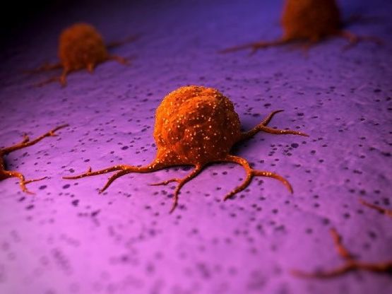"Tumori, presto test del sangue al posto della biopsia"