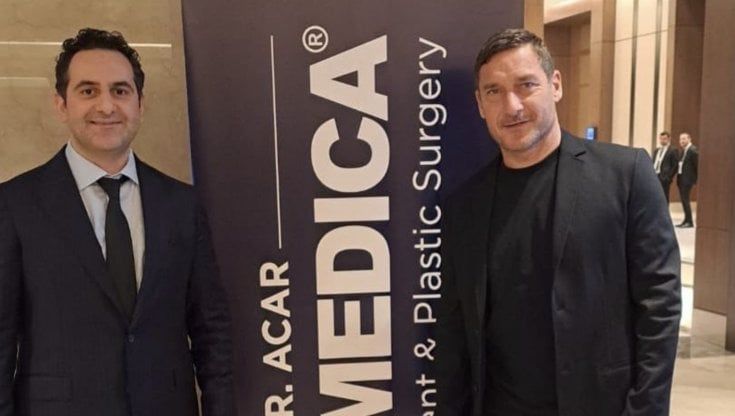 Francesco Totti come Cristiano Ronaldo: investe sul trapianto di capelli. E sarà anche testimonial