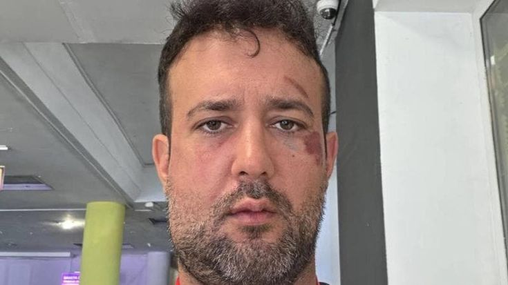 Segretario Pd di Mantova Adriano Stabile ferito in Ucraina: "Ho avuto paura, ma non mi fermo"