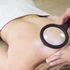 Melanoma: parte la campagna di prevenzione nelle sedi di Unicoop Firenze