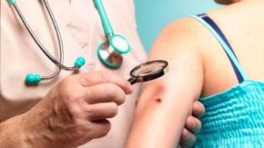 Melanoma, il primo vaccino personalizzato a mRNA riduce del 42% il rischio che il tumore ritorni