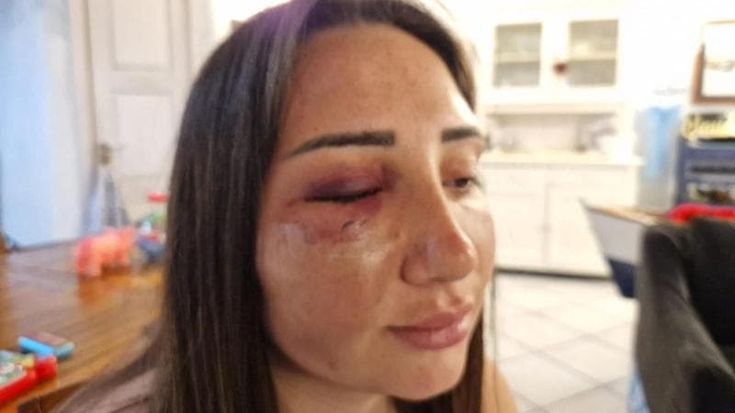 Donna massacrata dall’ex a Pozzuoli: lui in un video tiene il bimbo in braccio mentre picchia Gaia