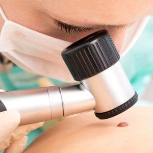 Melanoma, pembrolizumab riduce del 43% rischio di recidiva o morte dopo chirurgia 