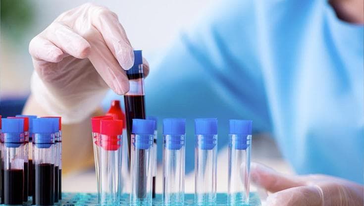 Nuove cure, enormi progressi: come cambia l’ematologia