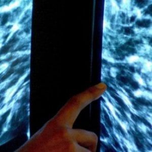 Breast Unit, la mortalità si riduce del 18% ma in molte regioni ancora non ci sono 