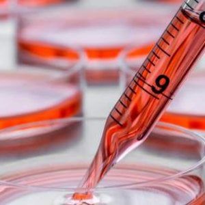 Tumori rari, nasce la Rete nazionale per garantire cure migliori