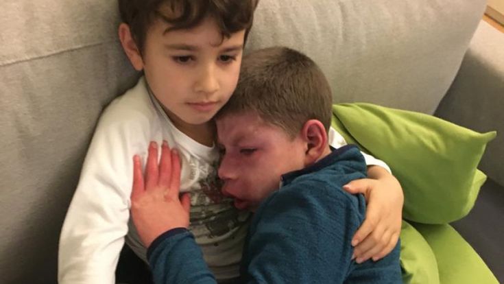 "Mio fratello è speciale"